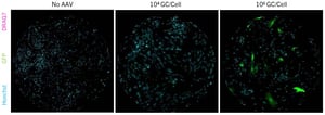AAV-in-HSCs-rep-images
