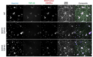 analysis-of-neurite-network