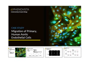 Migration-of-aortic-endothelial-cells-thumbnail-v2