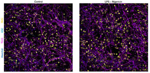 neuroinflammation-tri-culture-rep-images