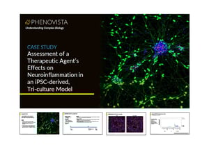 Neuroinflammation-tri-culture-thumbnail